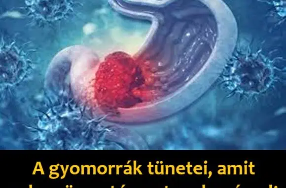 gyomorrak tunetei 580x381